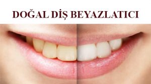 doğal diş beyazlatıcı - doğal diş beyazlatma - diş beyazlatma yöntemleri - evde diş beyazlatma - diş beyazlatma evde - diş beyazlatma evde nasıl yapılır - evde diş beyazlatma yöntemleri