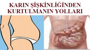 Karın şişkinliğinden kurtulmanın yolları - karındaki gaz nasıl giderilir bitkisel - karın şişkinliği sebepleri - mide şişkinliğine ne iyi gelir - karın şişkinliği nasıl giderilir - karın şişliği nasıl gecer - şişkinlik nasıl giderilir - karın şişliği neden olur nasıl geçer