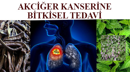 Akciğer kanserine bitkisel tedavi - akciğer kanserinden tamamen kurtulmak - akciğer kanserinden nasıl kurtulunur - akciğer kanserine iyi gelen bitkiler - akciğer kanserine iyi gelen yiyecekler - akciğer kanserine iyi gelen besinler - akciğer kansere iyi gelen bitkiler