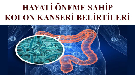 Kolon kanserinin belirtileri nelerdir - kolon kanseri belirtileri - kolon kanseri belirtisi - kalın bağırsak kanseri belirtileri - kalın bağırsak kanserinin belirtileri - bağırsak kanseri belirtileri - kolon kanseri belirtisi nelerdir - kolon kanseri belirtileri nelerdir