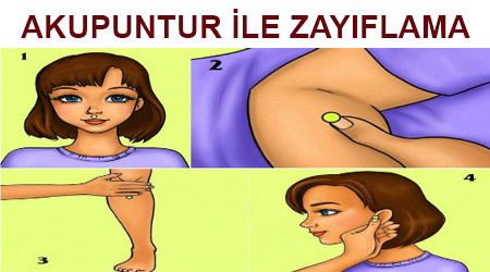 Akupuntur ile zayıflama