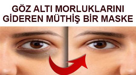 Goz Alti Kararmasi Icin Maske Hayat Ve Saglik Goz Alti Kararmasi Icin Maske Hayat Ve Saglik